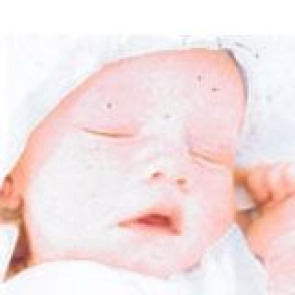 Notice Image