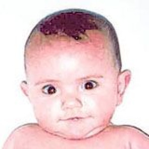 Notice Image